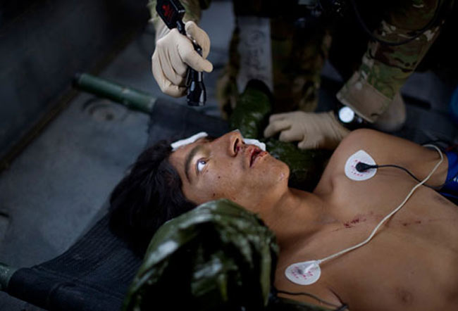 پسر زخمي شده افغان