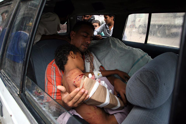 کودک مجروح یمنی