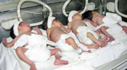 تولد نوزادان چهارقلو در همدان