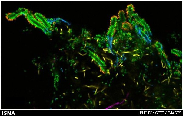 تصاویر رنگارنگ از میکروب‌های دندان