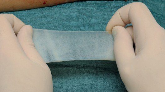 افزایش سرعت بهبود زخم‌ها با پانسمان‌ ضدباکتری