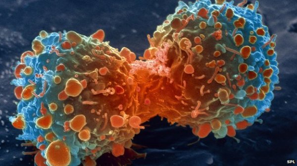 درمان سرطان با سلول‌های بنیادی قرضی