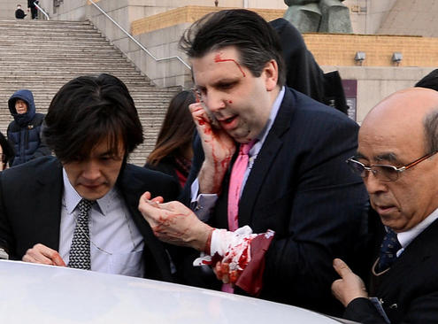 سفیر آمریکا در سئول در حال انتقال به بیمارستان. او از سوی یک فرد با تیغ ریش تراشی مورد حمله قرار گرفت