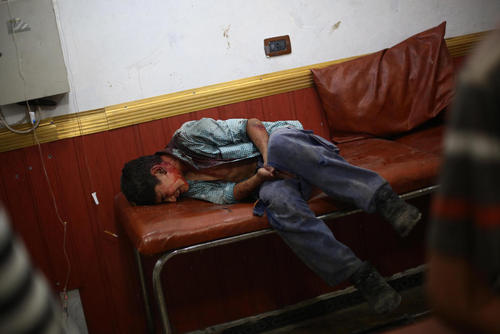 یک کودک زخمی از جنگ داخلی در بیمارستان شهر دوما در حومه شهر دمشق سوریه