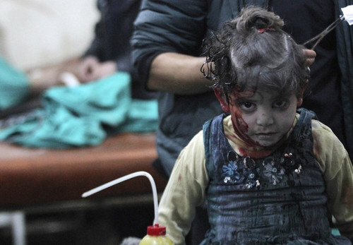 زخمی شدن دختر سوری