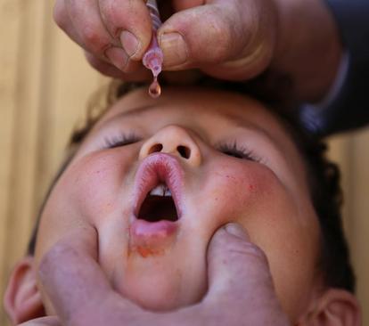 واکسیناسیون فلج اطفال در افغانستان