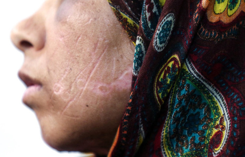 شکنجه یک زن و 2 دخترش/ آنها 21 روز غذا نخوردند اما هنوز زنده‌اند (+تصاویر)