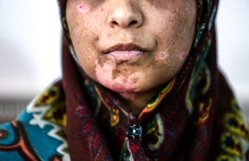شکنجه یک زن و 2 دخترش/ آنها 21 روز غذا نخوردند اما هنوز زنده‌اند (+تصاویر)