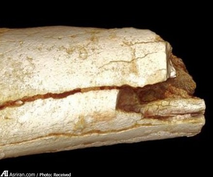 کشف رد پای ۱.۷ میلیون ساله "سرطان " در زندگی بشر(+عکس)