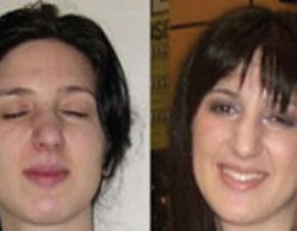 ناتالی آدلر ناتالی آدلر