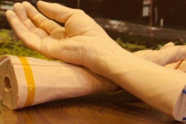 تشخیص سرطان با دستبند گوگل تشخیص سرطان با دستبند گوگل