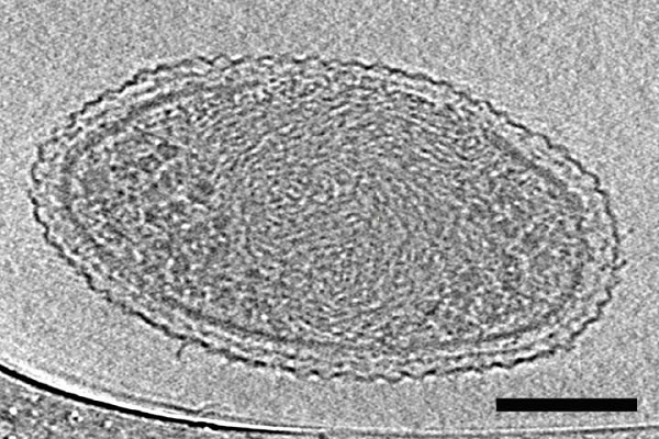 تصاویر میکروسکوپی دقیق از باکتری‌های فوق‌کوچک