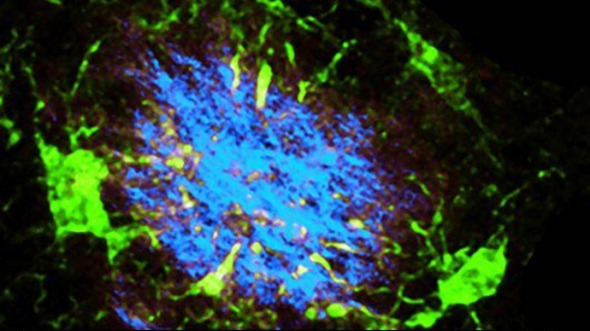 پروتئینی که ام‌اس و آلزایمر را رام می‌کند