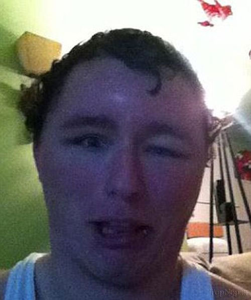 آلرژی این پسر را به این روز انداخت! (+عکس)