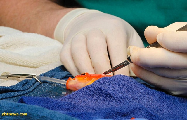 جراحی مغز متفاوت! جراحی مغز متفاوت!