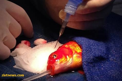 جراحی مغز متفاوت! جراحی مغز متفاوت!