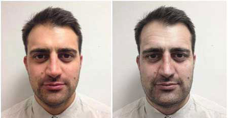 آنچه استرس بر سر صورت می‌آورد (+عکس)