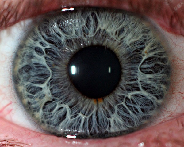 ریزسوزنهایی برای درمان دو بیماری کلیدی چشم ریزسوزنهایی برای درمان دو بیماری کلیدی چشم