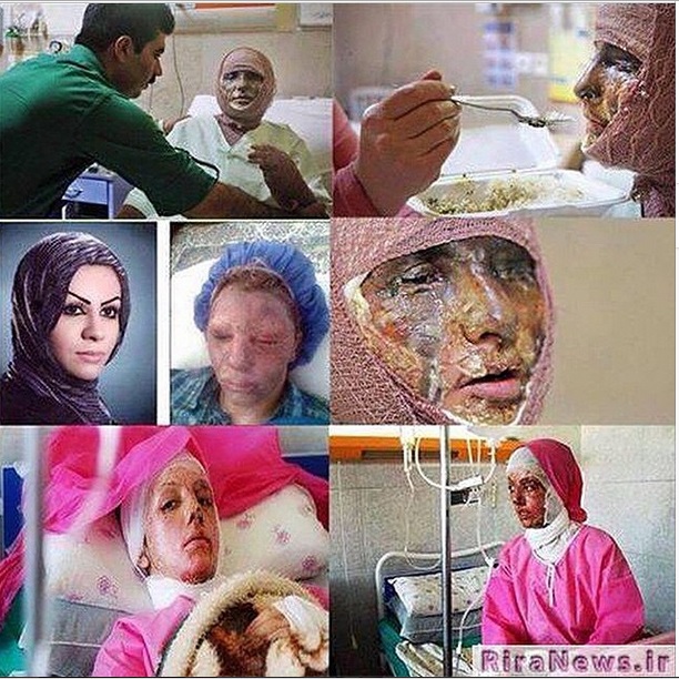 محمدموسوی :اسیدپاش ها از داعش هم بدترند