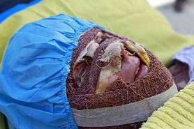 پدر سهیلا: اسیدپاش را بدهند خودم مجازات کنم پدر سهیلا: اسیدپاش را بدهند خودم مجازات کنم