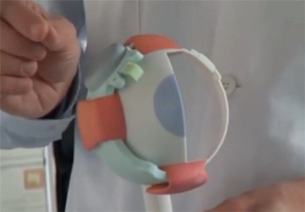 زن نابینا با چشم مصنوعی بینا شد+تصاویر زن نابینا با چشم مصنوعی بینا شد+تصاویر