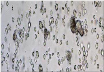 تولید واکسنهای سهبعدی برای مبارزه با سرطان و ایدز تولید واکسنهای سهبعدی برای مبارزه با سرطان و ایدز