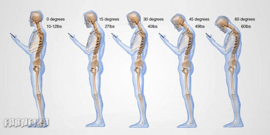 بلایی که موبایل بر سرتان می‌آورد (+عکس)