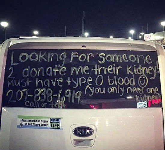 پیداکردن کلیه با روشی متفاوت! (+عکس)