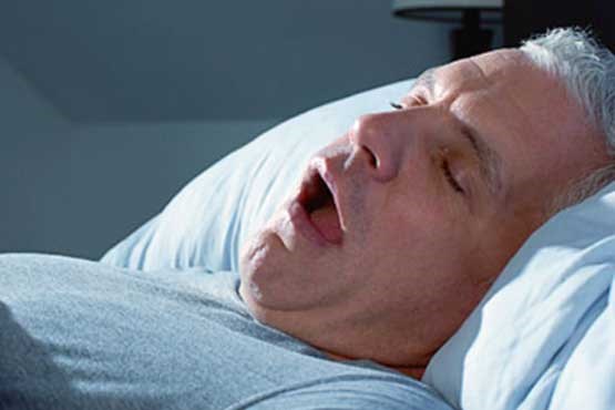 خروپف شدید علائمی از بروز دیابت و آلزایمر زودرس خروپف شدید علائمی از بروز دیابت و آلزایمر زودرس