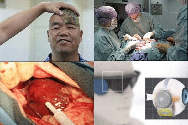 عجیبترین رخدادهای پزشکی در سالی که گذشت عجیبترین رخدادهای پزشکی در سالی که گذشت