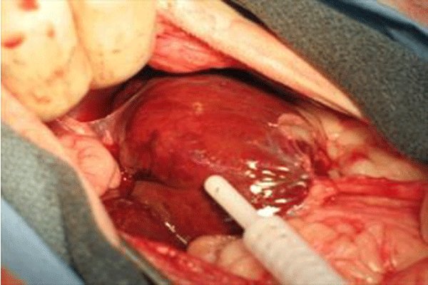 عجیبترین رخدادهای پزشکی در سالی که گذشت عجیبترین رخدادهای پزشکی در سالی که گذشت