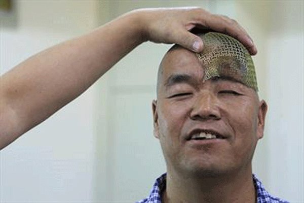 عجیبترین رخدادهای پزشکی در سالی که گذشت عجیبترین رخدادهای پزشکی در سالی که گذشت