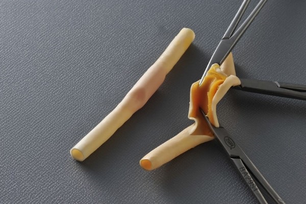 ساخت رگ مصنوعی توسط محققان ایرانی ساخت رگ مصنوعی توسط محققان ایرانی