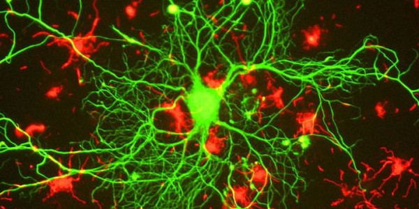 اسکن مغز در آینده پسورد شما خواهد بود! اسکن مغز در آینده پسورد شما خواهد بود!