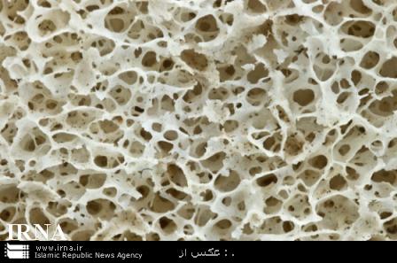 ترمیم بافت با استخوان تولیدشده ازچاپگر سه بعدی