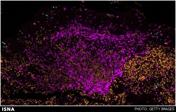 تصاویر رنگارنگ از میکروب‌های دندان