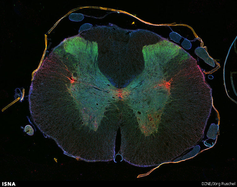 ارائه روشی جدید برای درمان آسیبهای نخاعی ارائه روشی جدید برای درمان آسیبهای نخاعی
