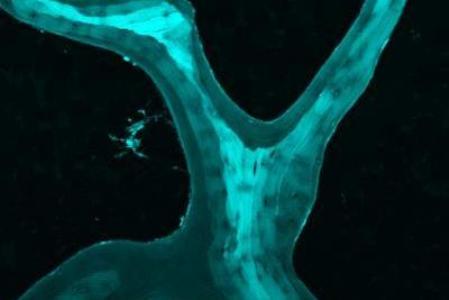 کشف یک ویژگی مهم در استخوان اسفنجی