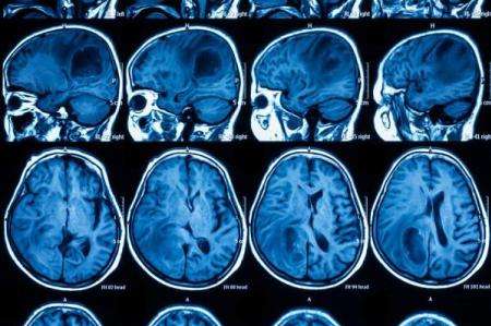 از بین بردن سرطان با سلول های پوست از بین بردن سرطان با سلول های پوست