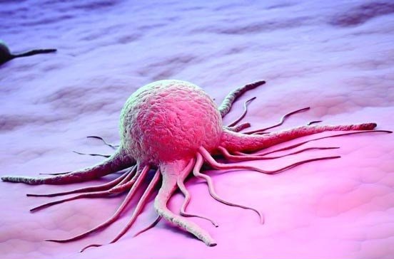 نتایج موفق مطالعات محققان ایرانی برای درمان سه نوع سرطان