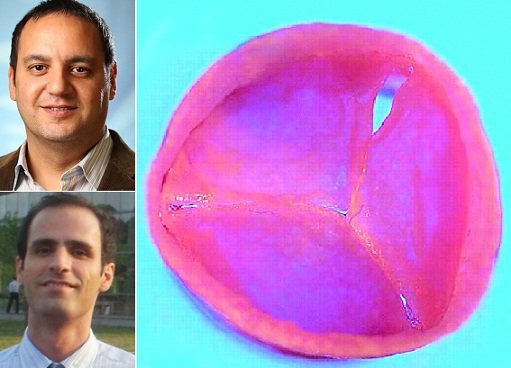 ساخت دریچه قلب هیبریدی بادوام توسط دانشمندان ایرانی ساخت دریچه قلب هیبریدی بادوام توسط دانشمندان ایرانی