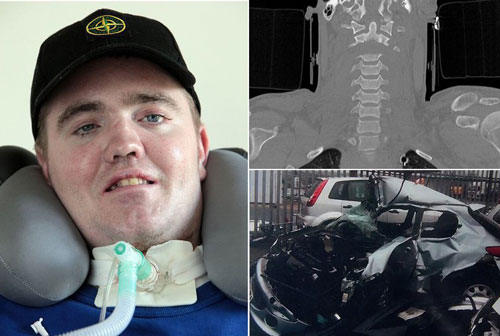 بازگشت به زندگی مردی که سرش قطع شد! بازگشت به زندگی مردی که سرش قطع شد!