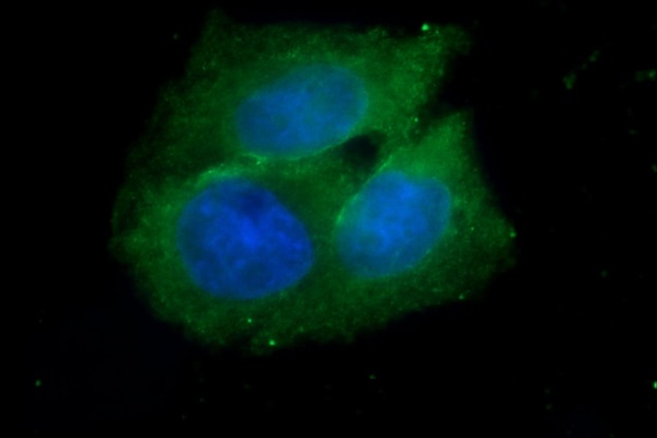 کشف پروتیین عامل رشد سلول های سرطانی