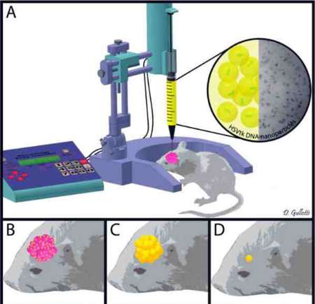 ژن درمانی جدیدترین روش درمان سرطان مغز