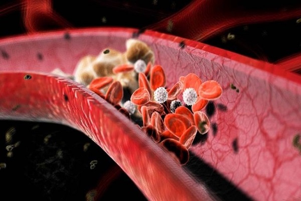 نانوروباتها رگهای گرفته قلب را باز می‌کنند