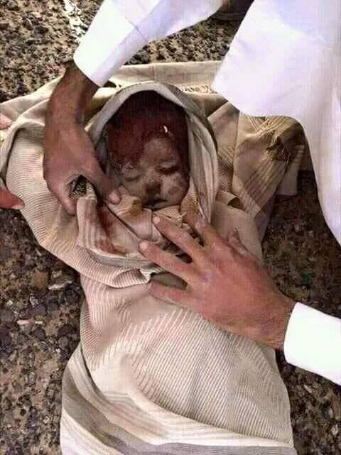 عربستان انتقام جمعه خونین را از کودکان می گیرد (عکس18+)