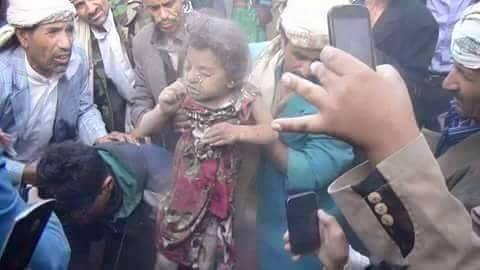 عربستان انتقام جمعه خونین را از کودکان می گیرد (عکس18+)