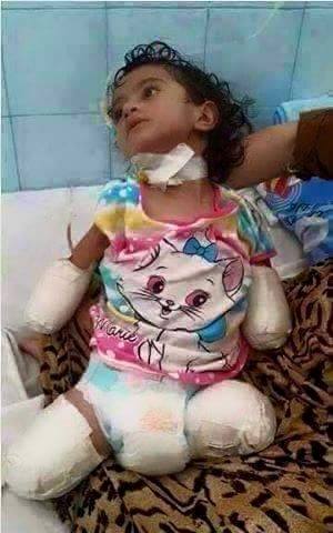 عربستان انتقام جمعه خونین را از کودکان می گیرد (عکس18+)