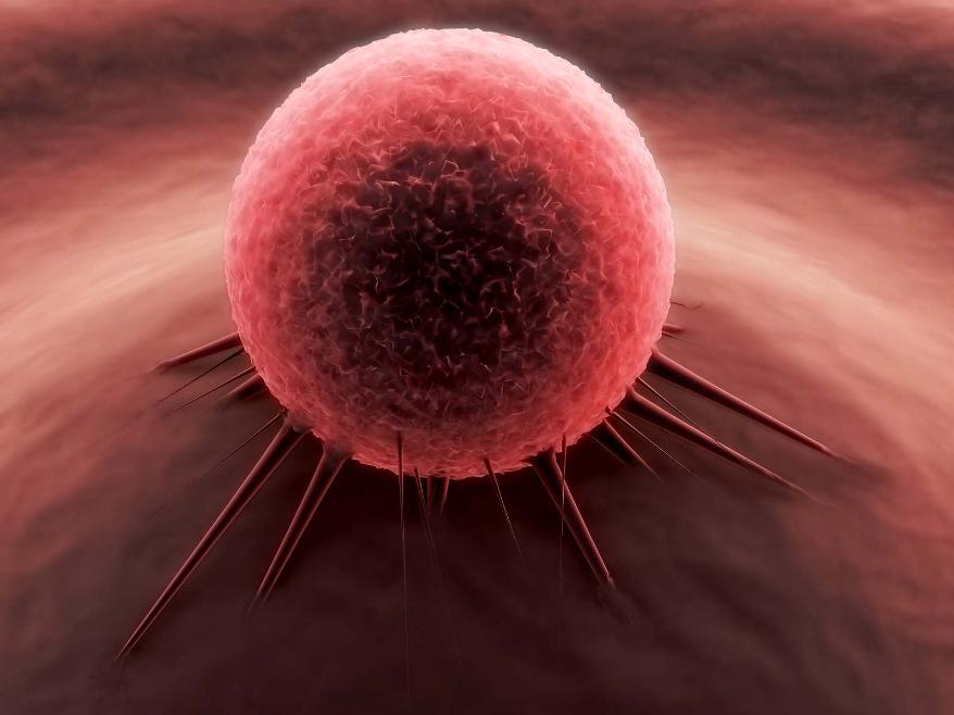 آمار های تکان دهنده وزارت بهداشت از دلایل افزایش ابتلا به سرطان/ حتما بخوانید و شیوه زندگی خود تان را اطلاح کنید