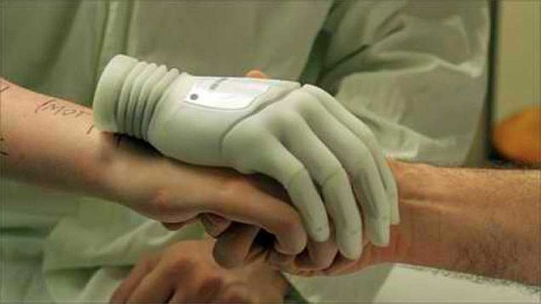 ساخت دست و پای مصنوعی با چاپگر سه بعدی